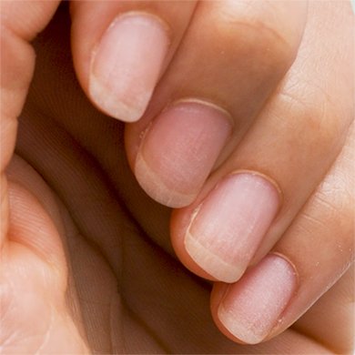 closeup of fingernails without polish on a medium skin hand showing dryness