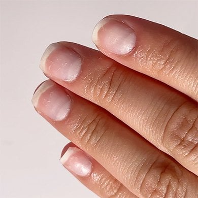 Closeup of medium skin hand showing four outstretched fingers with dry, brittle nails