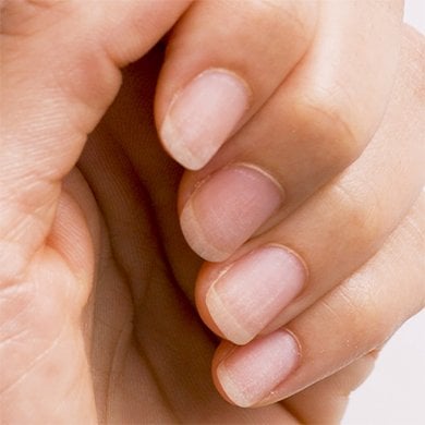 Closeup of four medium-length fingernails on a light skin hand that are pale and weak