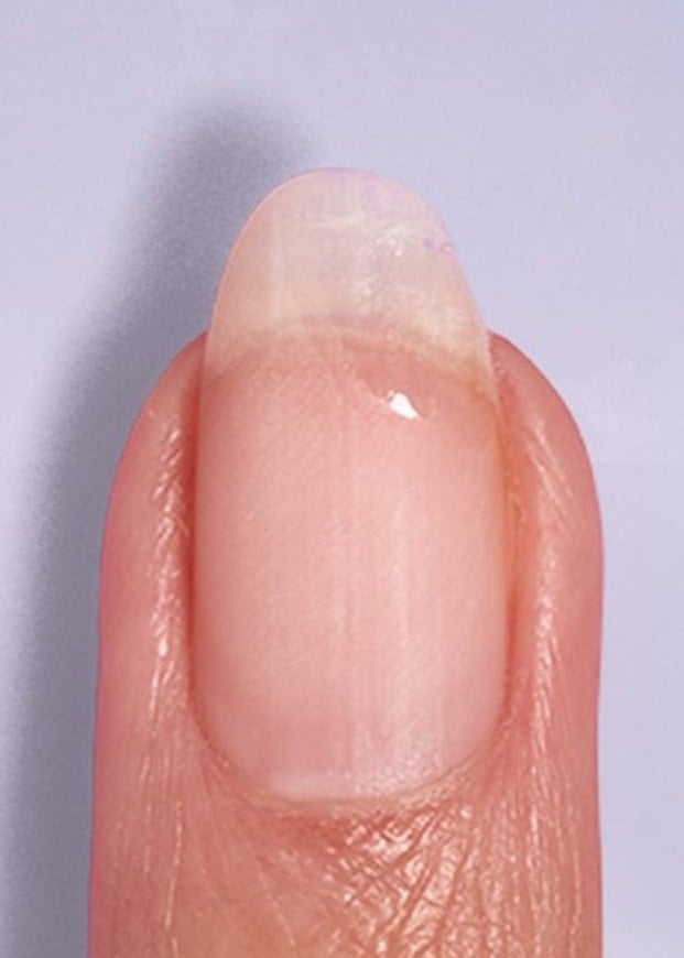 After Break Fix Liquid Nail Patch
