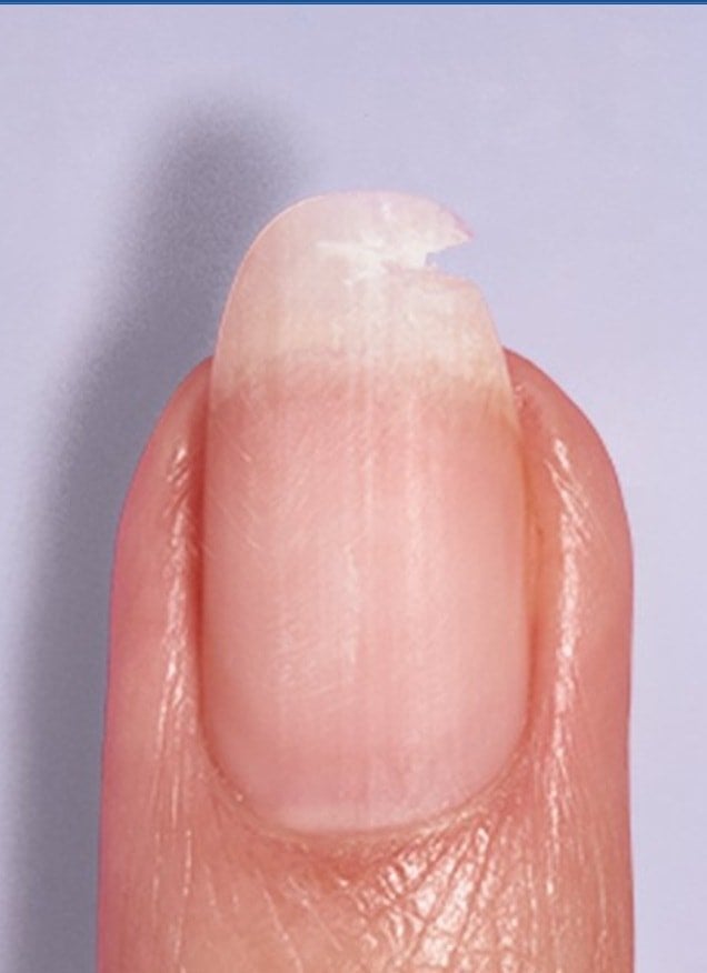 Before Break Fix Liquid Nail Patch