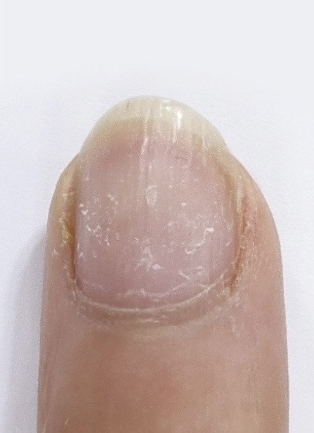 TTR_BA_Slider_Fingers_A