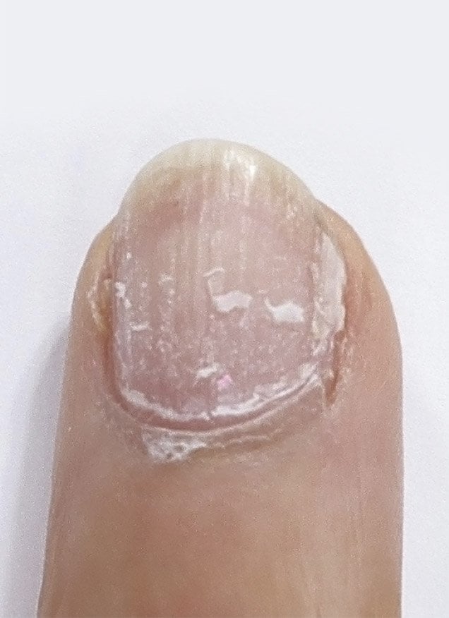 TTR_BA_Slider_Fingers_B