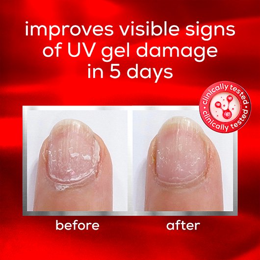 image of brittle nails before and after 5 days use of essie nails treatment with red background.